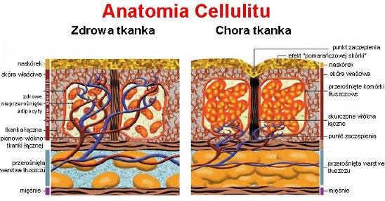 anatomia cellulitu