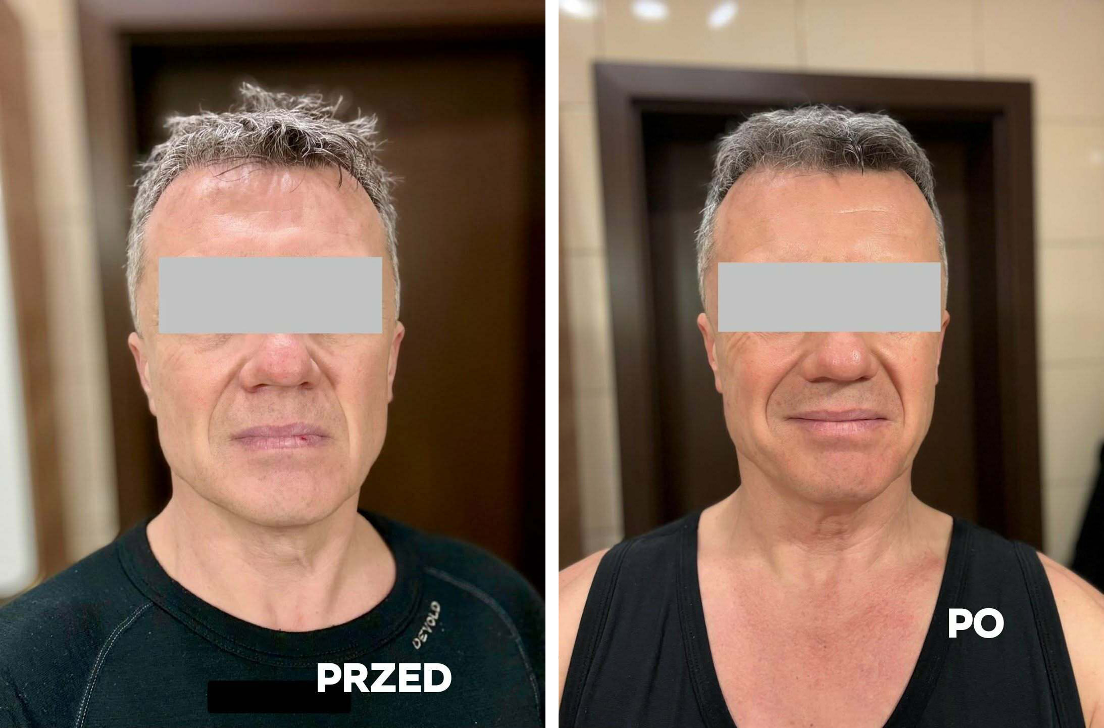 zdjęcie przed mona lab krzysztof copy