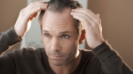 Zabiegi powstrzymujące wypadanie włosów u mężczyzn
