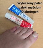 Recenzja kremów Diabetegen i Diabetegen Forte