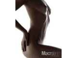 Powiększanie biustu i modelowanie sylwetki – Macrolane