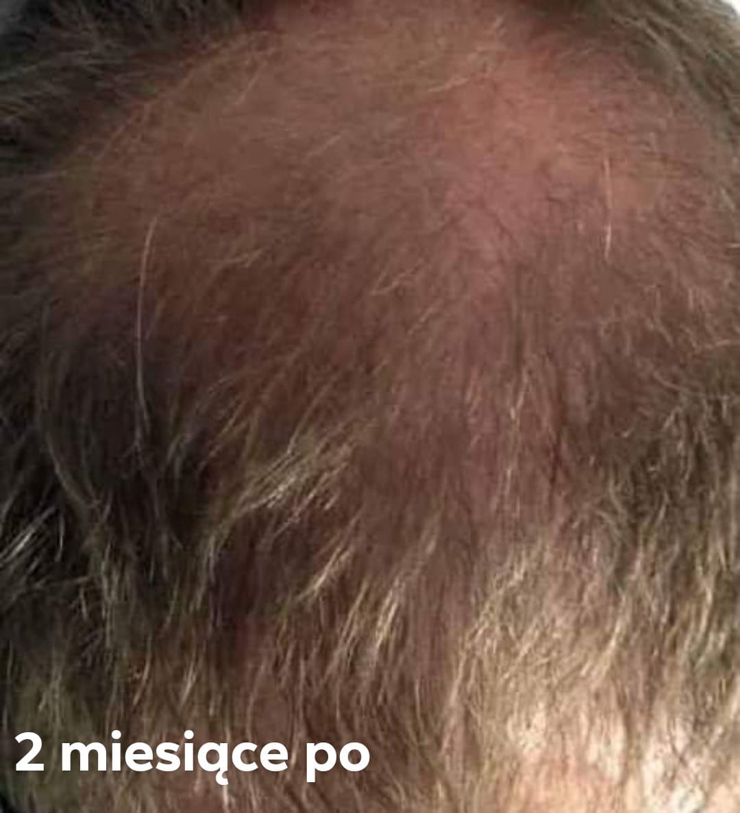 Venita Bio Natural Care