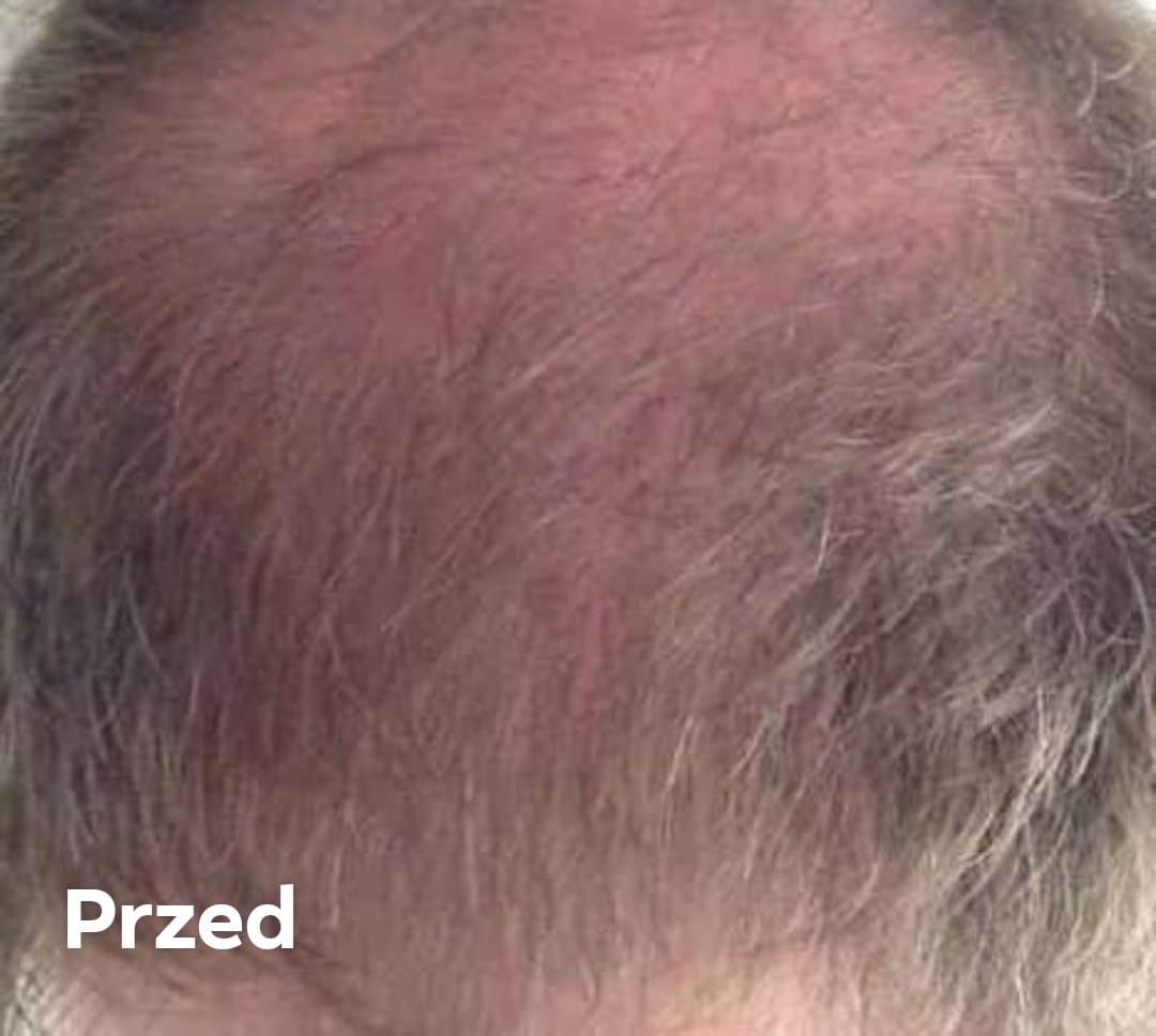 Venita Bio Natural Care