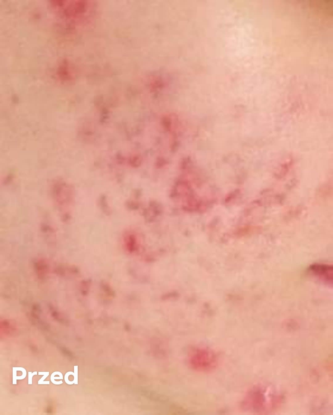 Venita Bio Natural Care