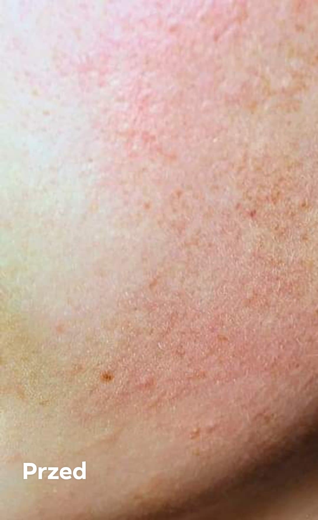 Venita Bio Natural Care