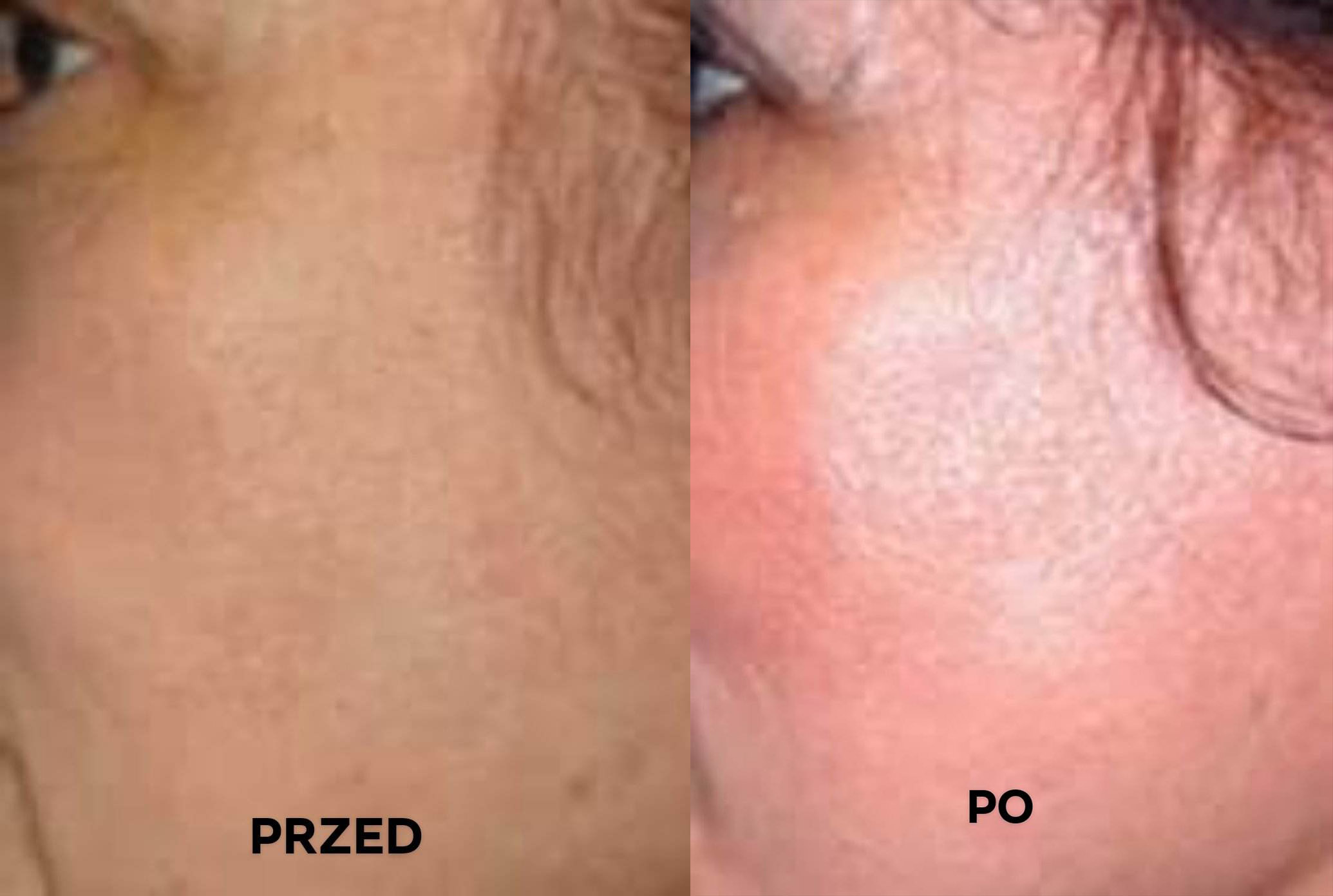 przed i po