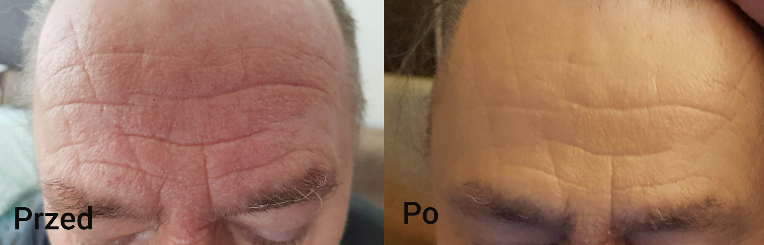 przed i po