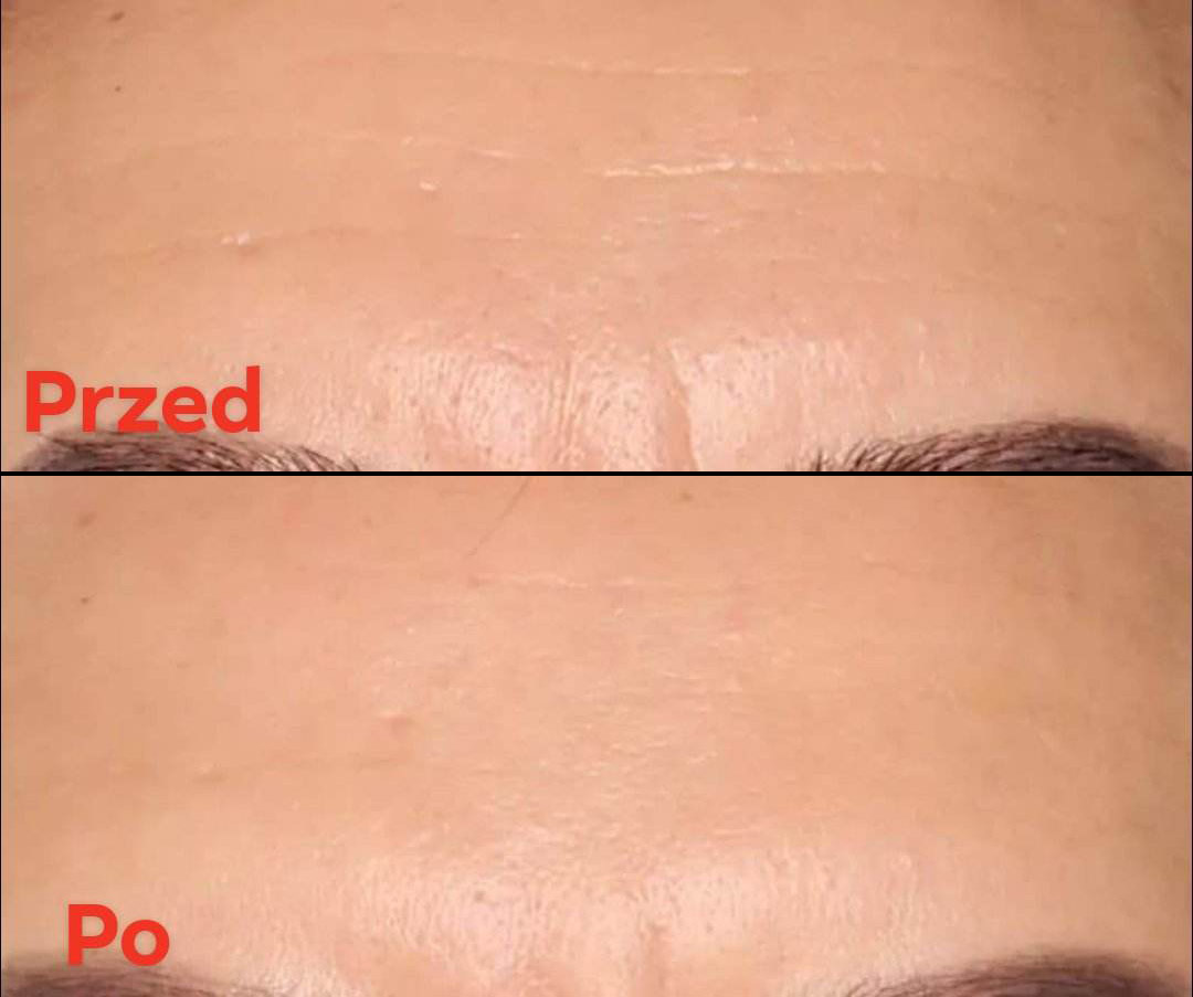 testerka 2 zdjęcie przed i po superactive