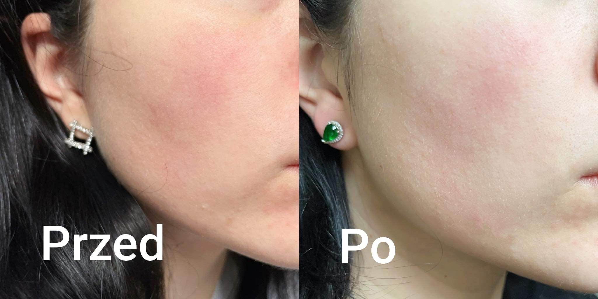 testerka nr 1 zdjęcie przed i po kremy BIOrythm