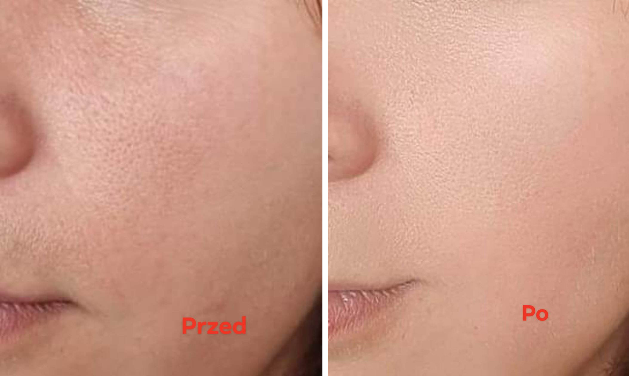 testerka nr 2 krem biorythm przed i po