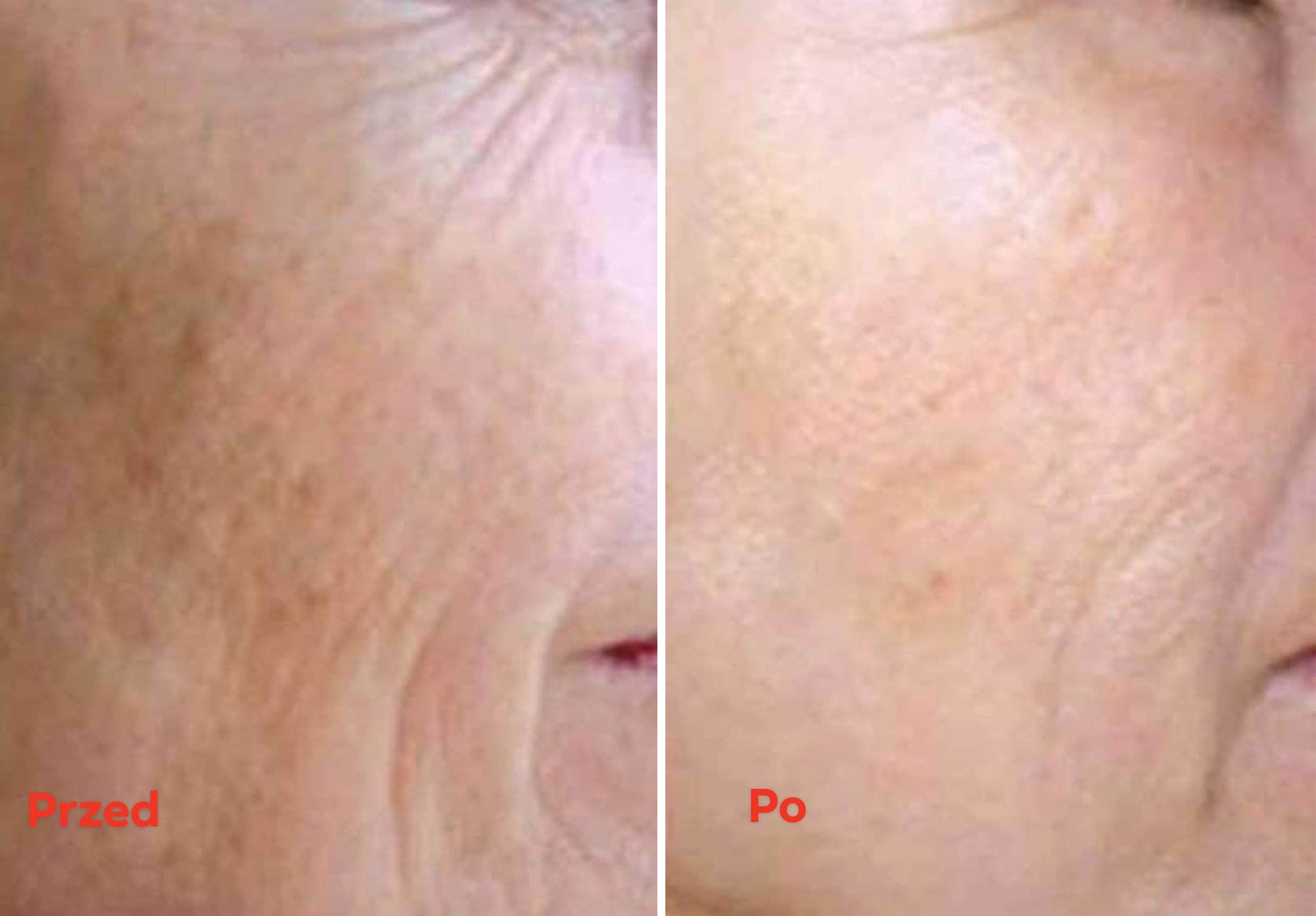 zdjecie przed i po testerka 1 olejek biorythm