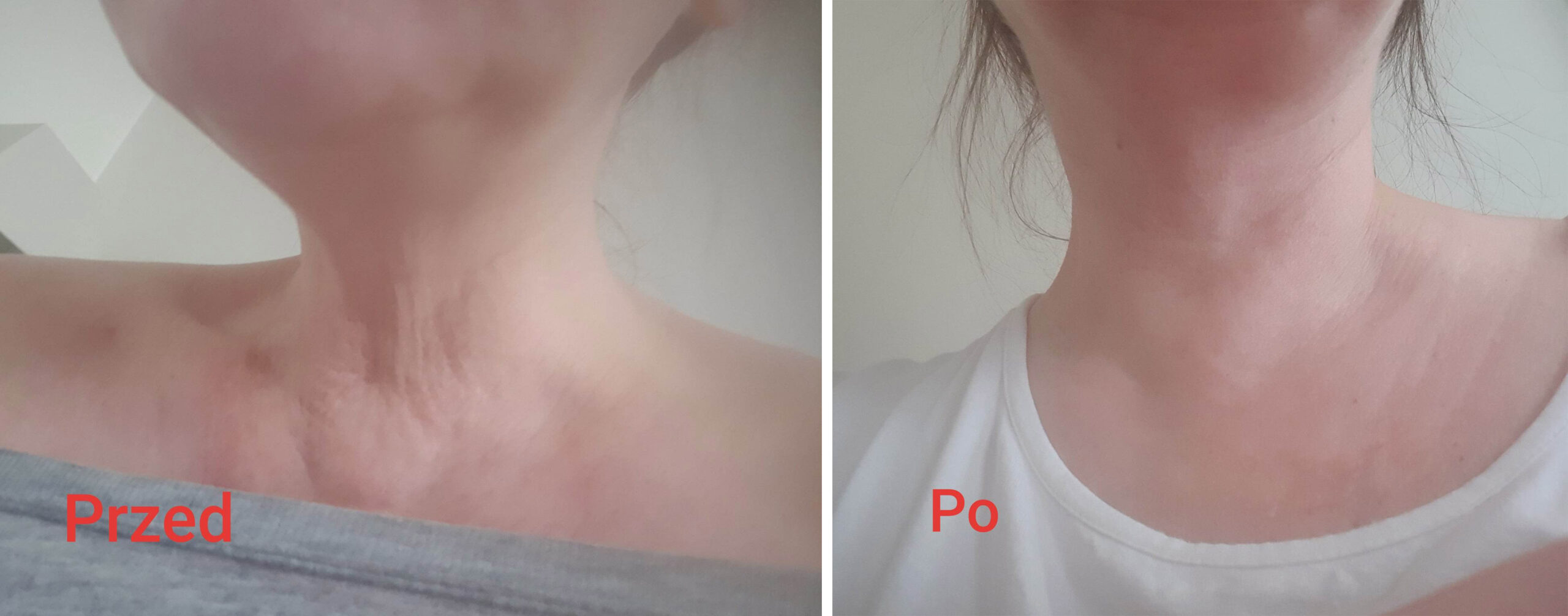 zdjecie przed i po testerka 2 olejek biorythm