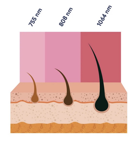 3 wiązki światła