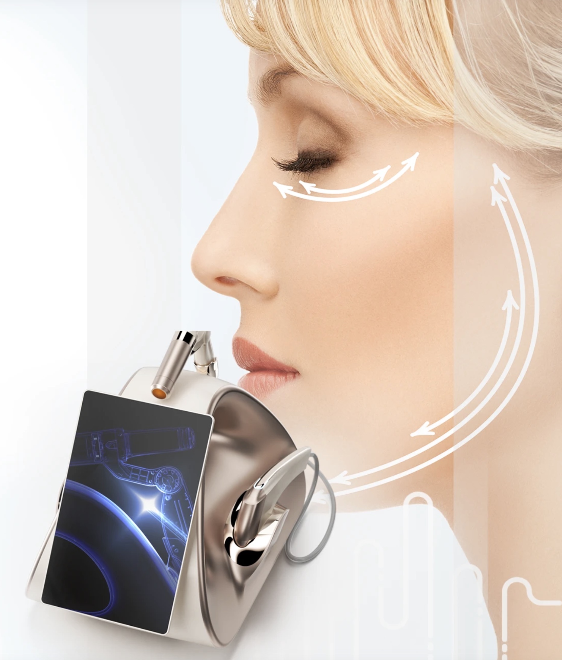 TECHNOLOGIA MIKROPULSOWANIA MPT