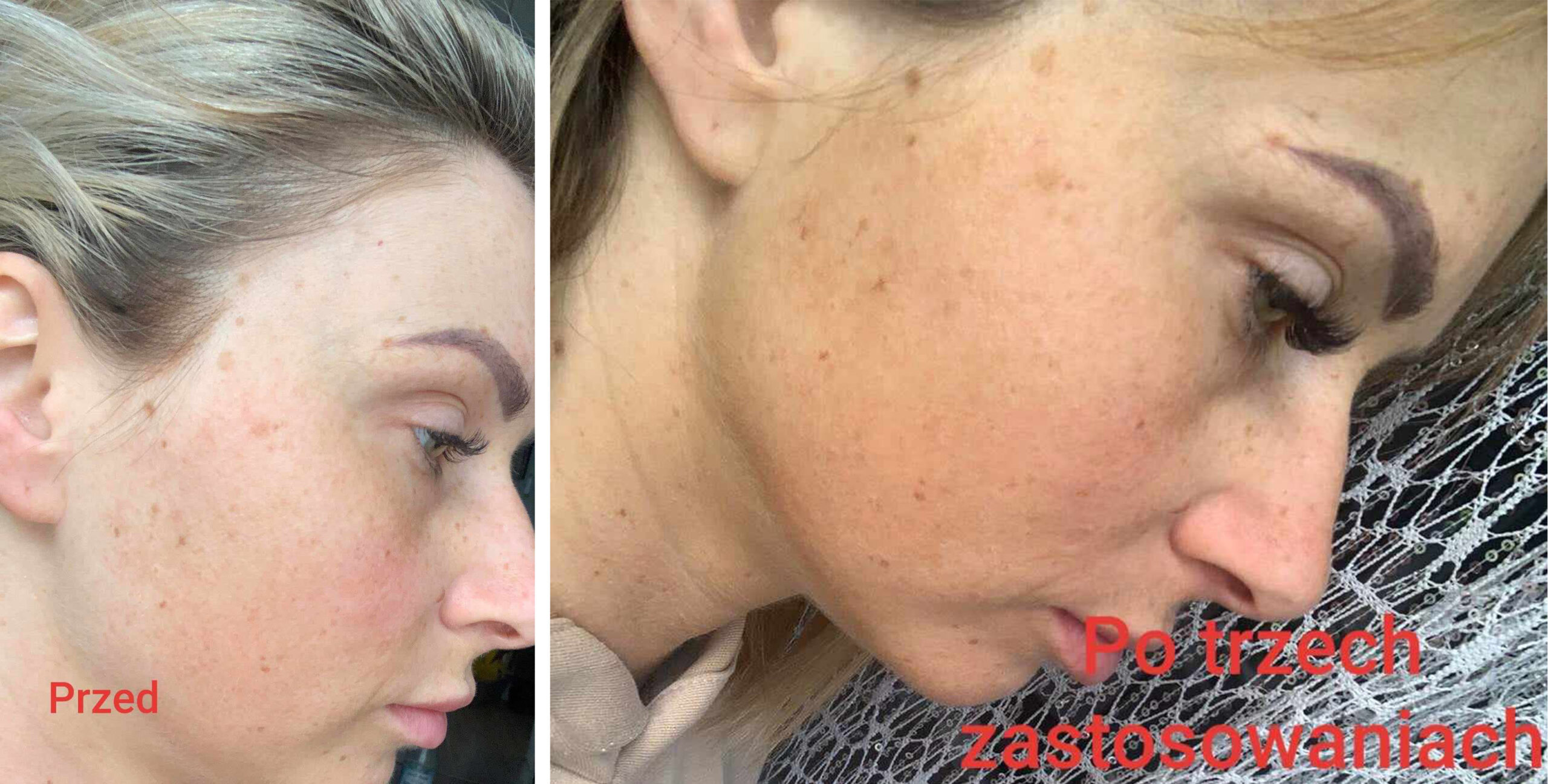 zdjecie przed i po olejek onyx