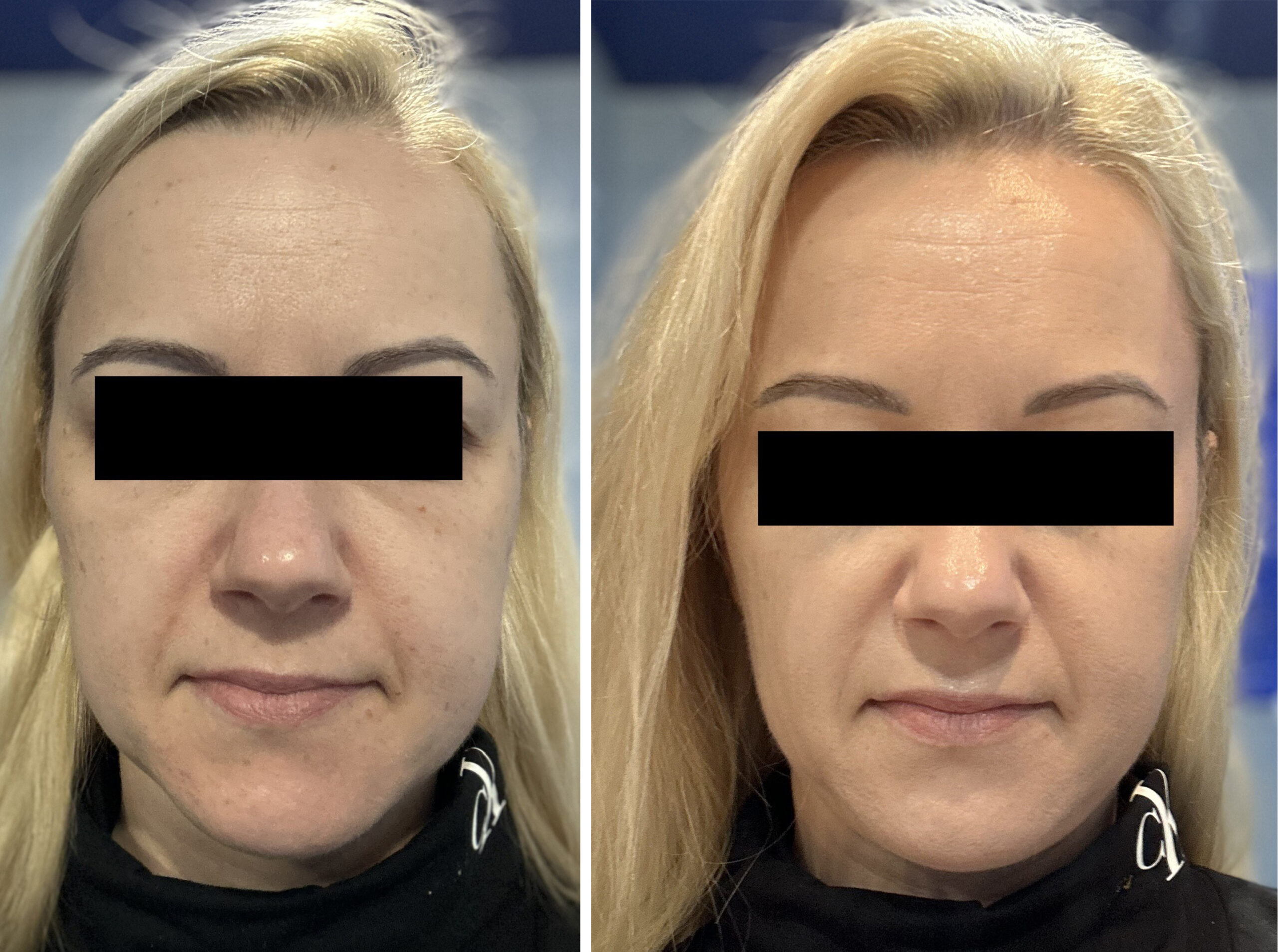 PRZED i PO zozu testerka nr 1