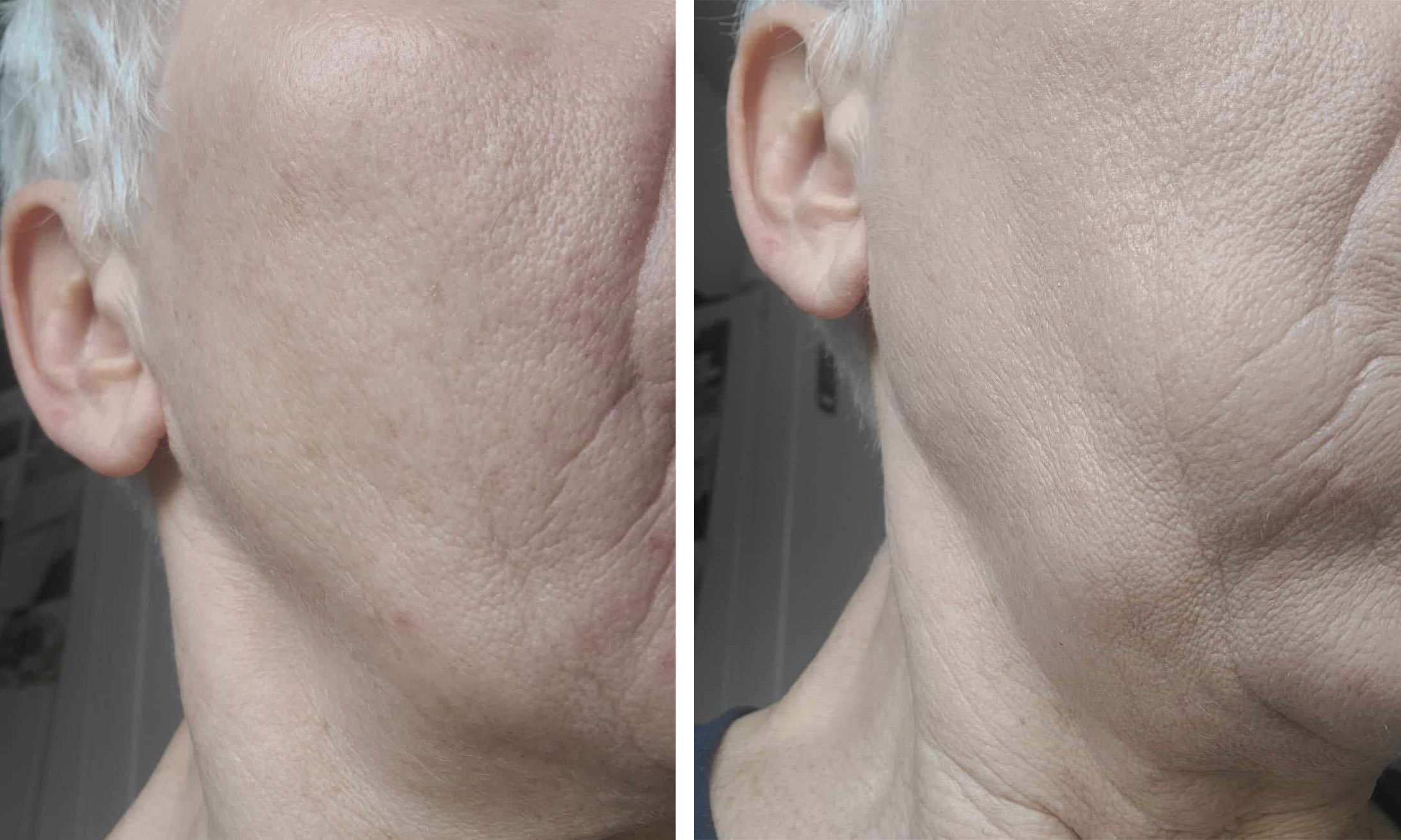 ZOZU PRZED i PO testerka nr 2 2 copy