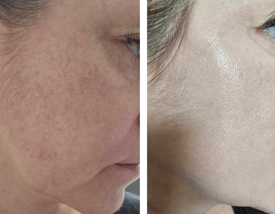 ZOZU PRZED i PO testerka nr 3