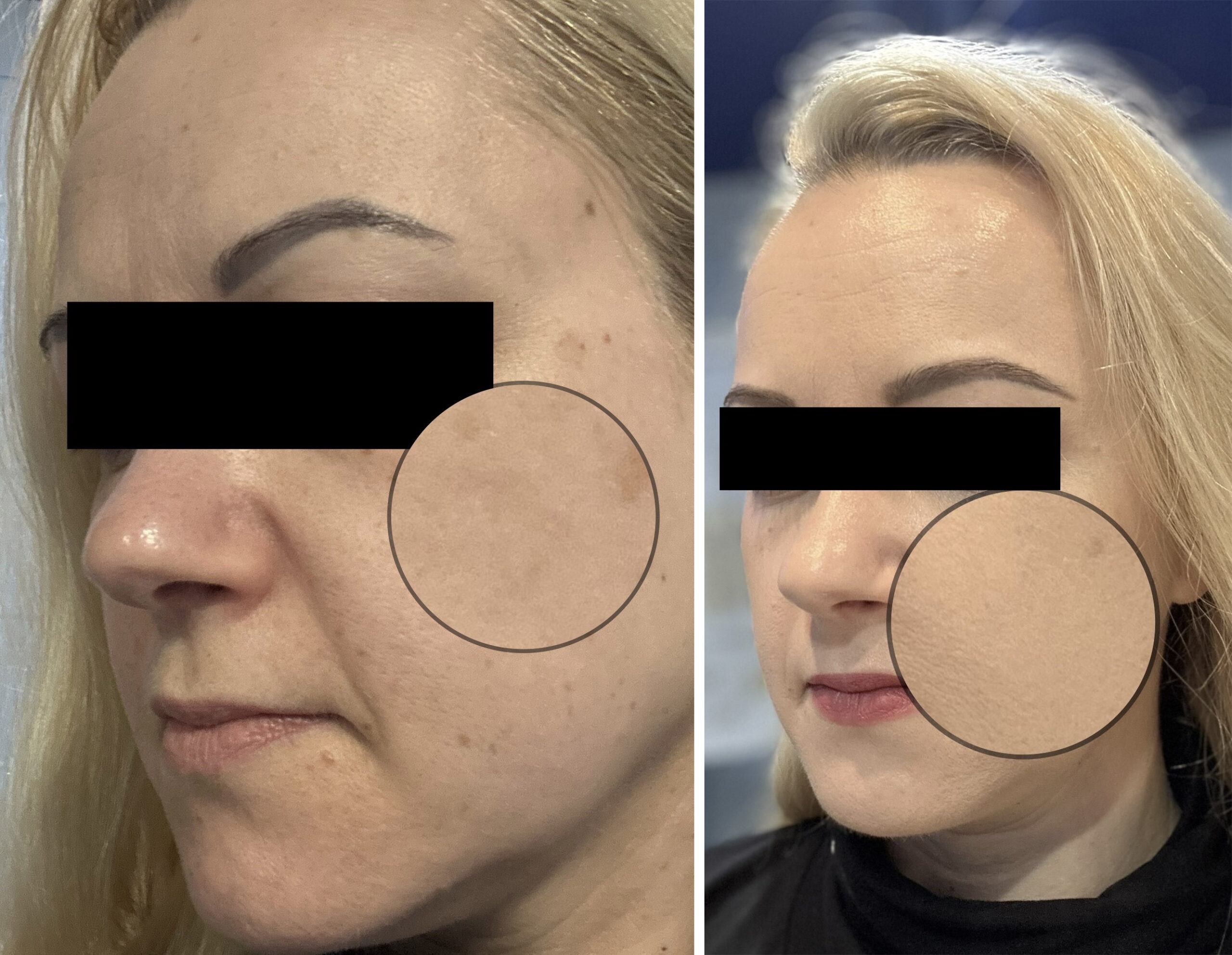 zozu PRZED i PO testerka nr 1 copy