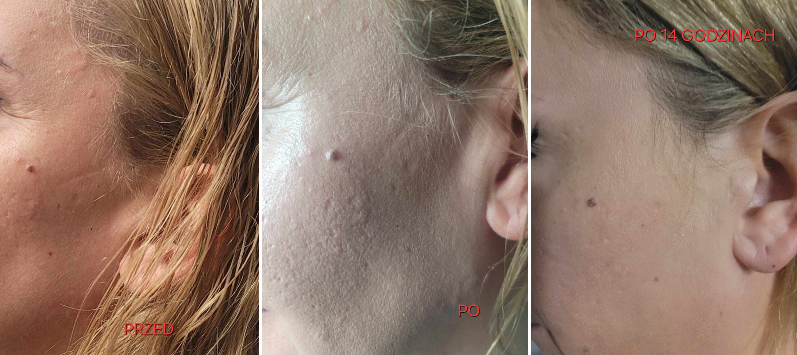 testerka 2 przed i po