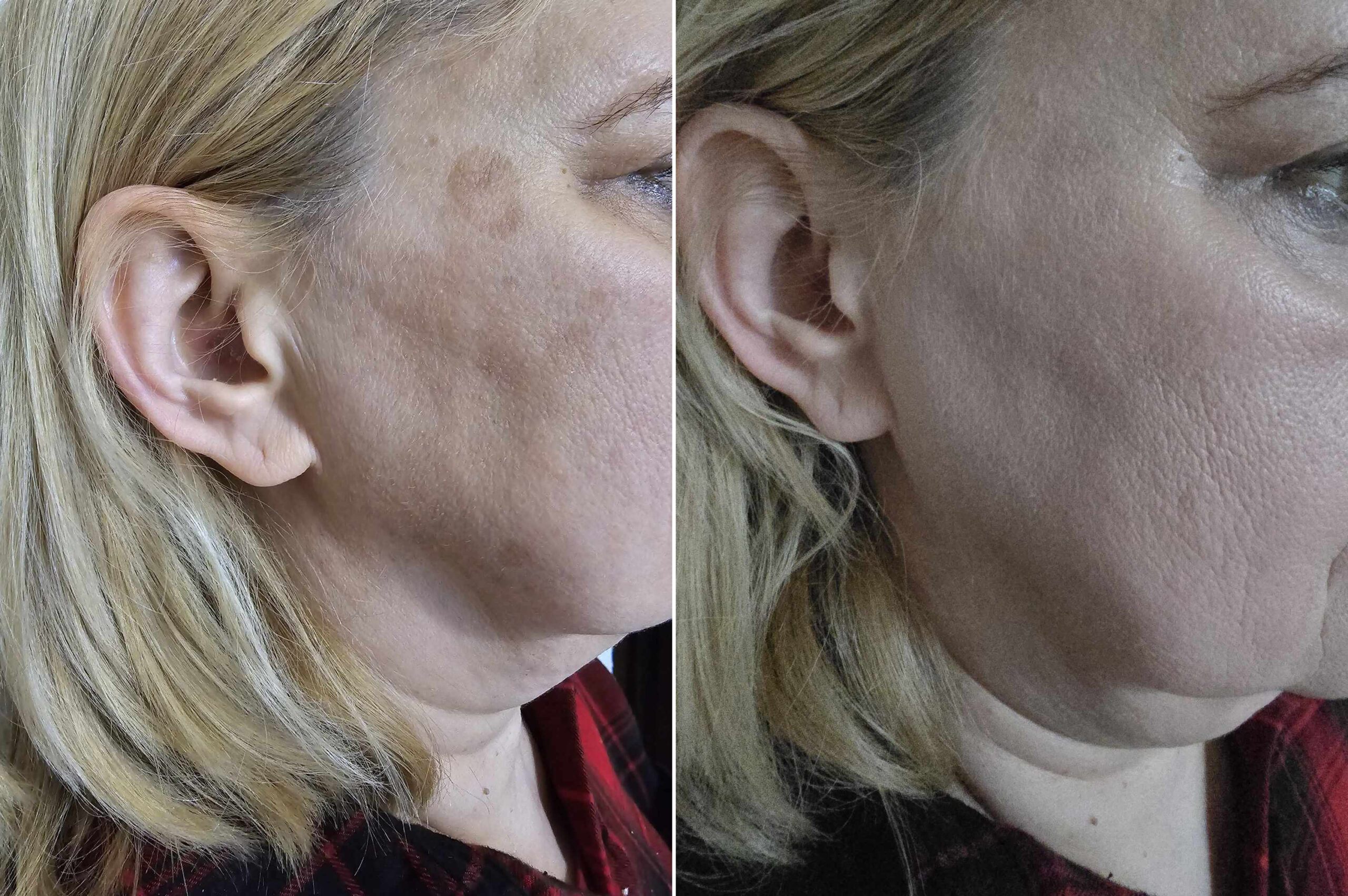 testerka 3 przed i po