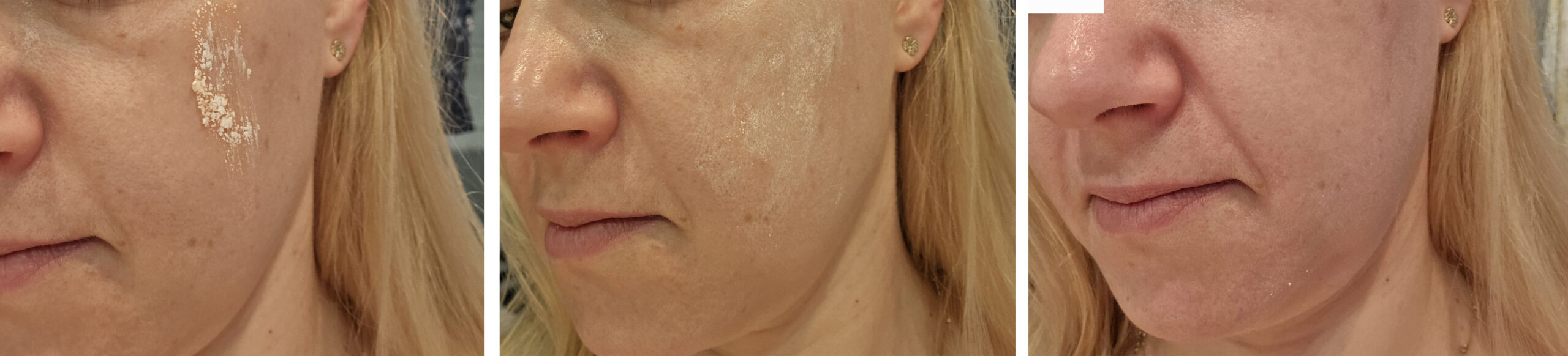 stosowanie zdjecie 1 pupsik copy