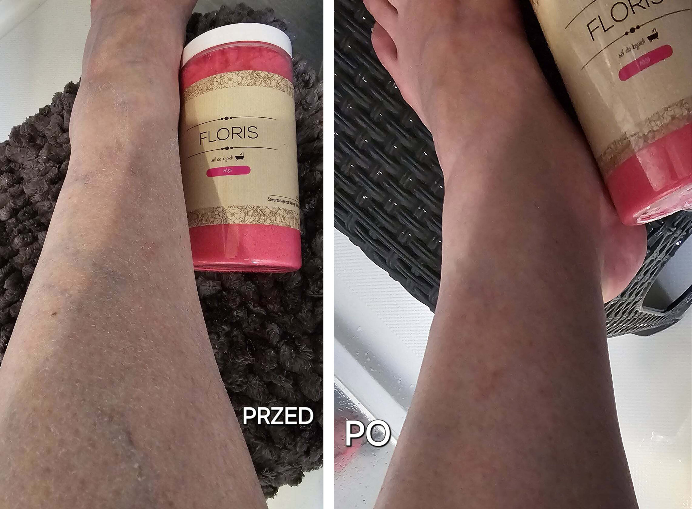 sól floris przed i po