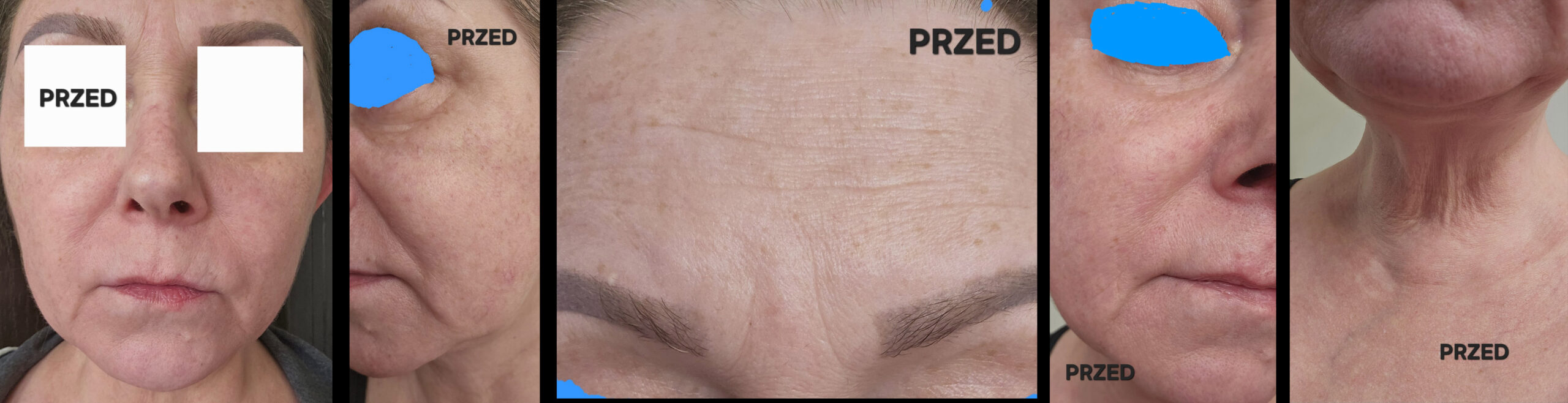 Zdjęcie 1clare copy