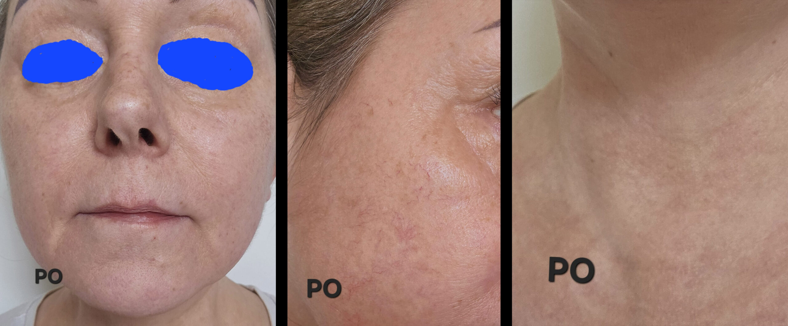 Zdjęcie 6 clare copy